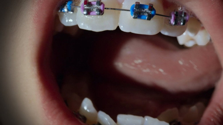 Open Wide still 3